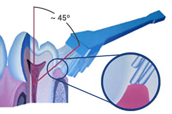 Zähne putzen nach Dr. Bass