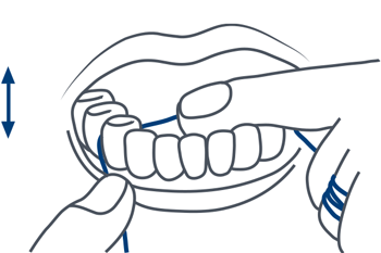 Anwendung Zahnseide Unterkiefer Zahnarzt LU Hasle