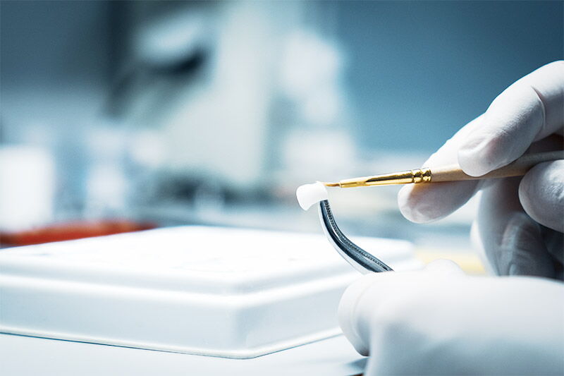 Veneers Zahnästhetik EDELWEISS-DENTAL Hasle Luzern